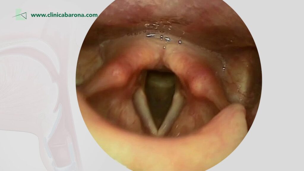 Vibrato y falsete: El canto más destacado